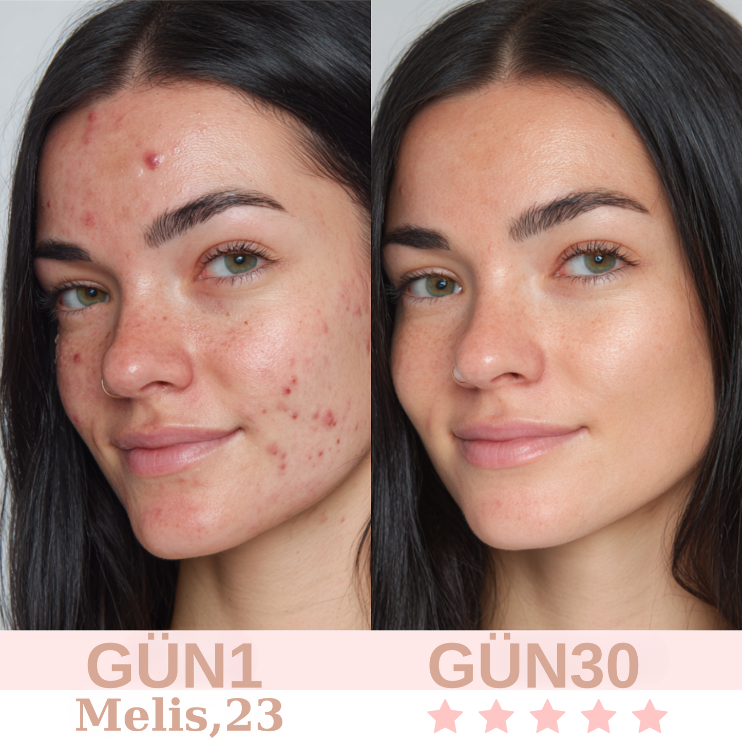 Yüz şekillendirici