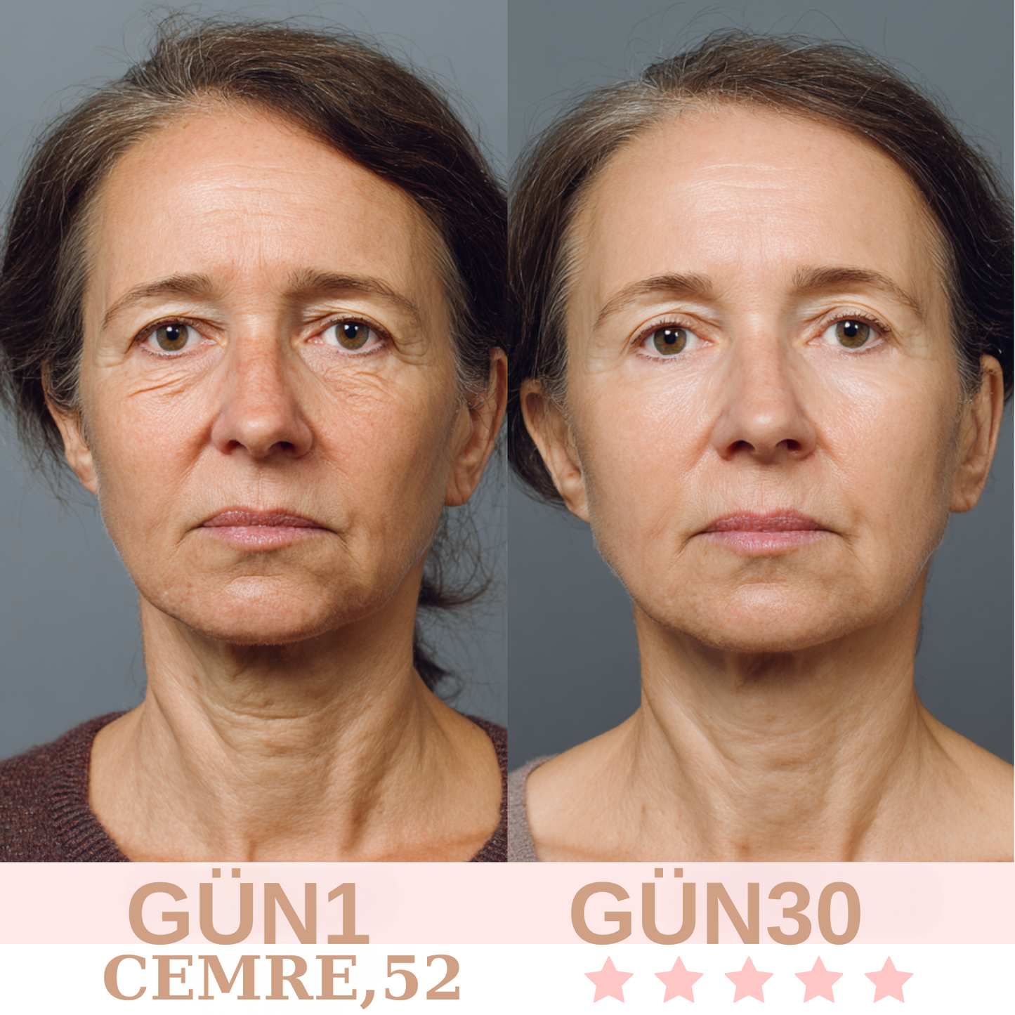 Yüz şekillendirici