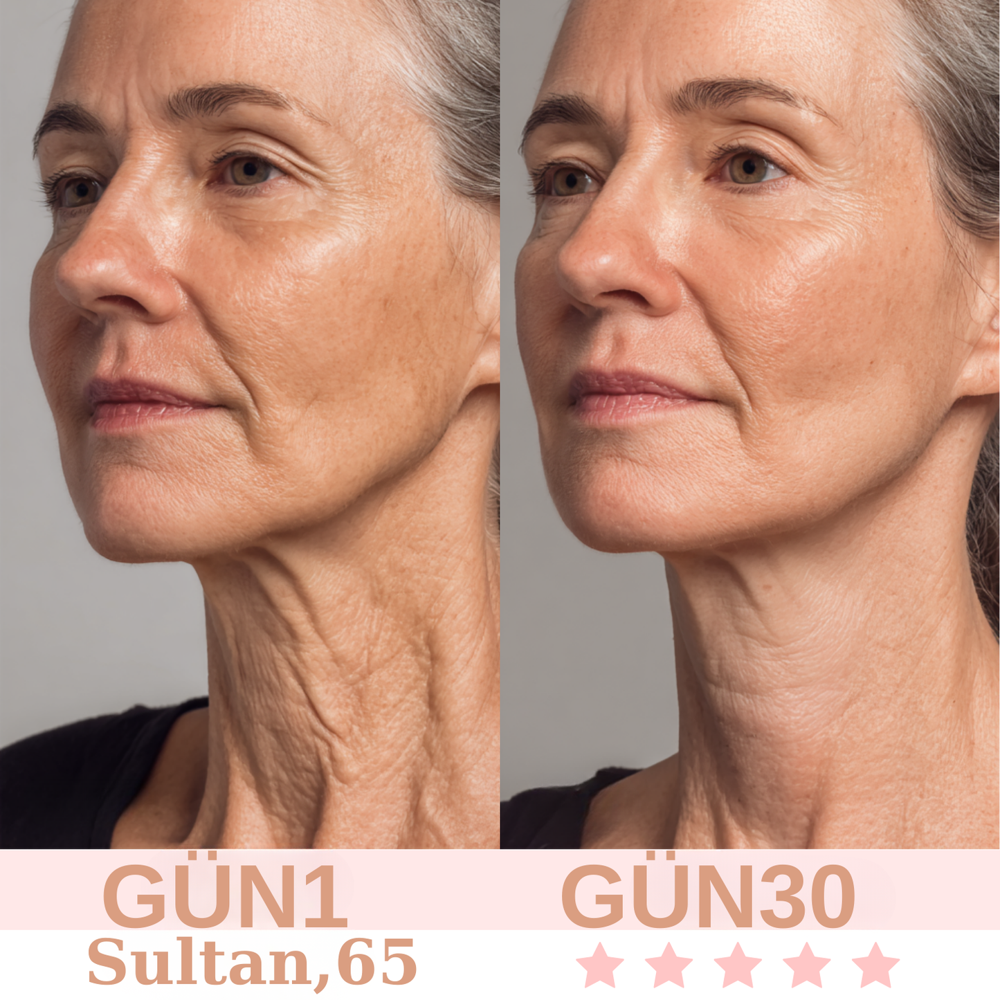 Yüz şekillendirici